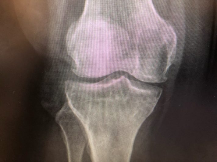 5FF4C5BD-7083-4C1D-84F7-7FFD978D9736